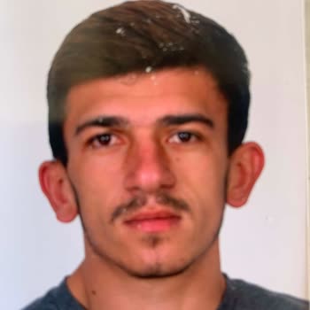 Başarısız Burun Ameliyatı Sonrası Mağduriyet Ve Revizyon Talebi