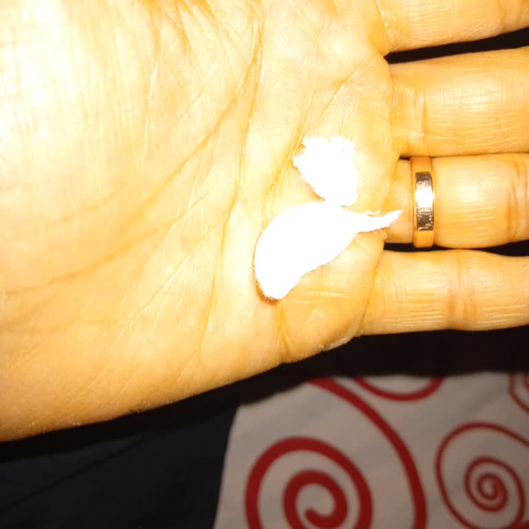 Baby Turco 7 Numara Bezde Sert Cisimler Nedeniyle Bebeğimin Rahatsızlanması