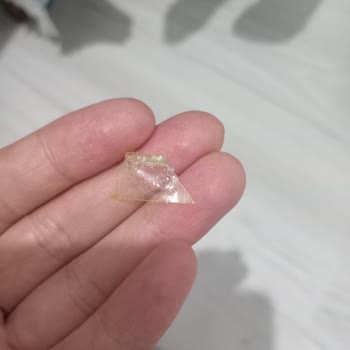 Gıda Ürününden Çıkan Plastik Parça Çocuğumun Sağlığını Tehlikeye Attı