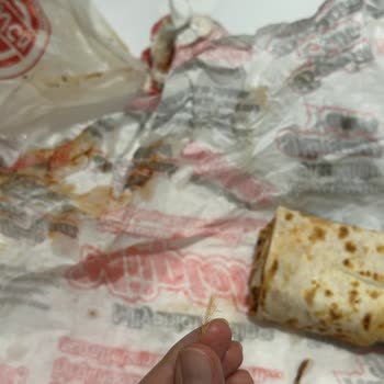 Hijyen Sorunu Ve Bozuk Ürün Nedeniyle Sağlık Riski Yaşadım