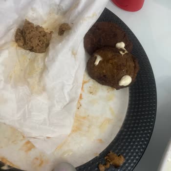 Köfte İçinden Çıkan Sert Parçalar Çocuklarımı Korkuttu