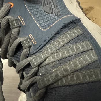 Garantili Skechers Ayakkabıda Kısa Sürede Deformasyon Ve Olumsuz Servis Yanıtı