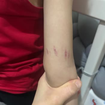 Çocuklarım Oyun Alanında Şiddete Maruz Kaldı, Güvenlik Ve İade Talebim Cevapsız Kaldı