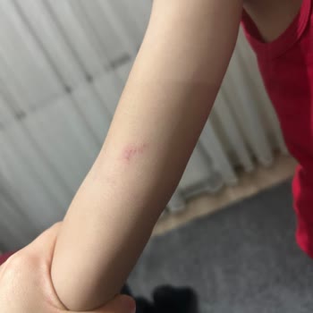 Çocuklarım Oyun Alanında Şiddete Maruz Kaldı, Güvenlik Ve İade Talebim Cevapsız Kaldı