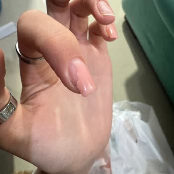 Yanlış Bilgilendirme, Hijyen Sorunu Ve Eksik Hizmet Nedeniyle Mağduriyet