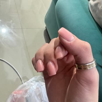 Yanlış Bilgilendirme, Hijyen Sorunu Ve Eksik Hizmet Nedeniyle Mağduriyet