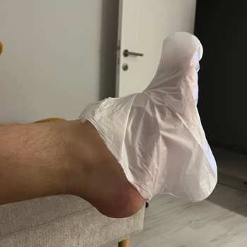 Aldığım Ayak Maskesi Ayağıma Olmadı Ve Yırtıldı Mağaza Yardımcı Olmadı