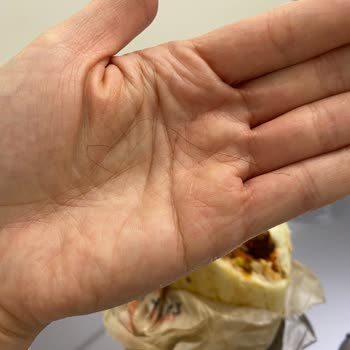 Köfteci Yusuf'ta Aldığım Köfteden Saç Çıktı, Hijyen Konusunda Endişeliyim