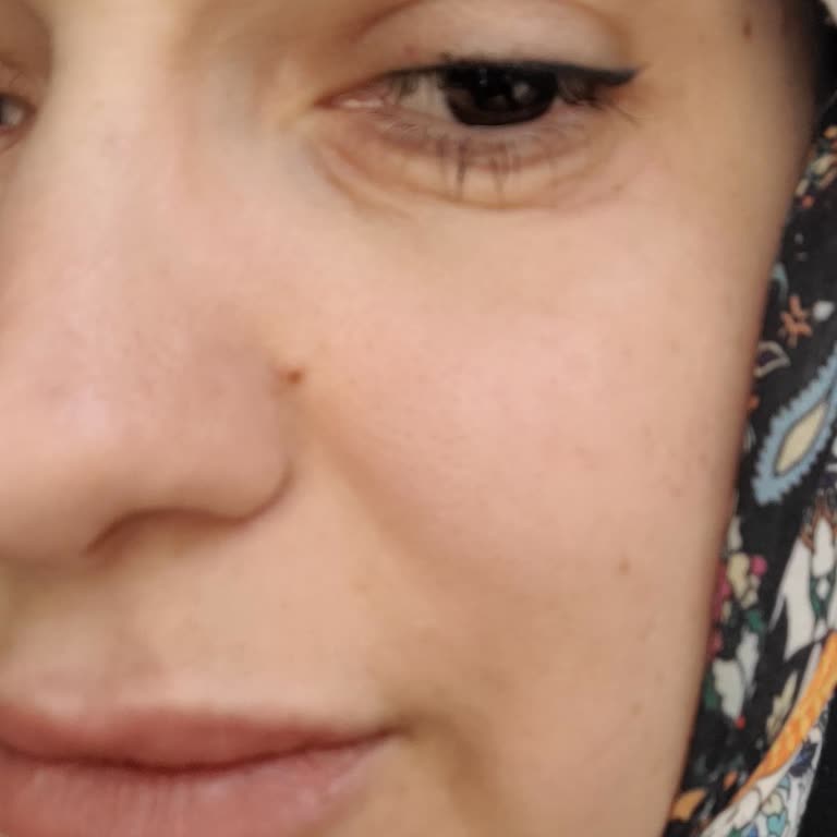 Estee Lauder Advanced Night Repair Eye Cream causa irritación ocular