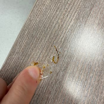 Noodle Siparişimden Ambalaj Parçası Çıktı Hijyen Ve Çözüm Konusunda Mağduriyet Yaşadım