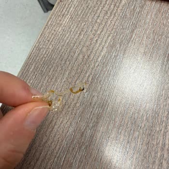 Noodle Siparişimden Ambalaj Parçası Çıktı Hijyen Ve Çözüm Konusunda Mağduriyet Yaşadım