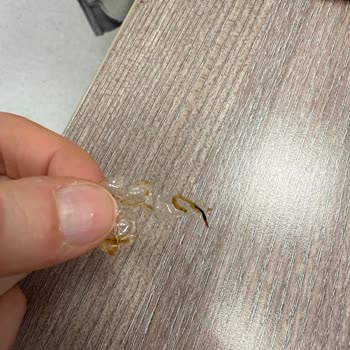 Noodle Siparişimden Ambalaj Parçası Çıktı Hijyen Ve Çözüm Konusunda Mağduriyet Yaşadım