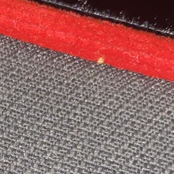 Otobüste Tahta Kurusu Şoku Ve Yetersiz Hijyen