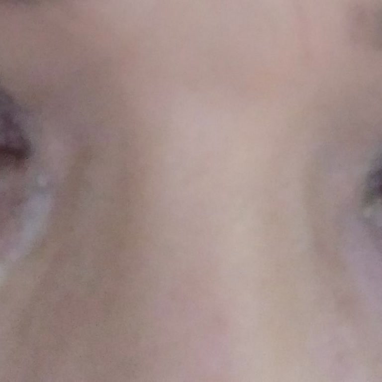 Golden Rose Rimel Gözde Yanma Ve Kaşıntı Yaptı, İade Talebim Var