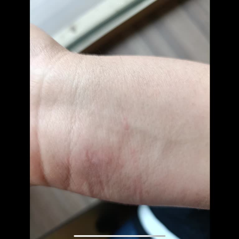 Setur Turizm Anemon Otel'de Hijyen Eksikliği Nedeniyle Konaklamada Rahatsızlık Yaşadım