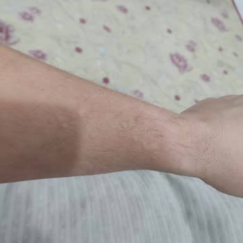 Deva İlaç Dodex'te Yaşadığım Yan Etkiler Hayatımı Olumsuz Etkiledi!