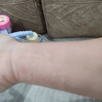 Deva İlaç Dodex'te Yaşadığım Yan Etkiler Hayatımı Olumsuz Etkiledi!