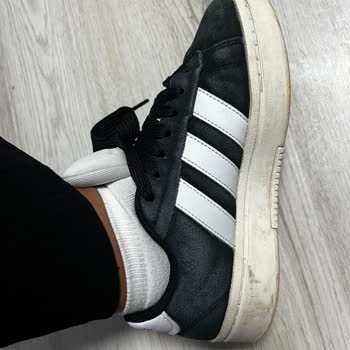 Adidas Ayakkabıda Renk Solması Ve Beklenmedik Kalite Sorunu