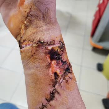 Ameliyat Tarihinde Belirsizlik Ve Yetersiz Bilgilendirme Nedeniyle Mağduriyet