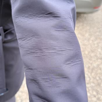 Aldığım Pardösüde Hızlı Deformasyon Ve Satıcıdan Yanıtsızlık