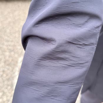 Aldığım Pardösüde Hızlı Deformasyon Ve Satıcıdan Yanıtsızlık