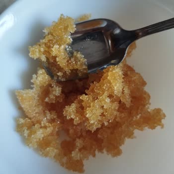 Balparmak Balda Anormal Köpüklenme Ve Şekerlenme Şikayeti