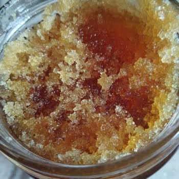 Balparmak Balda Anormal Köpüklenme Ve Şekerlenme Şikayeti