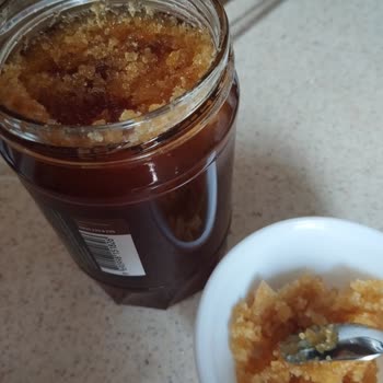 Balparmak Balda Anormal Köpüklenme Ve Şekerlenme Şikayeti