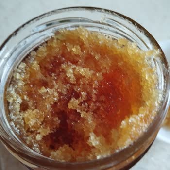 Balparmak Balda Anormal Köpüklenme Ve Şekerlenme Şikayeti