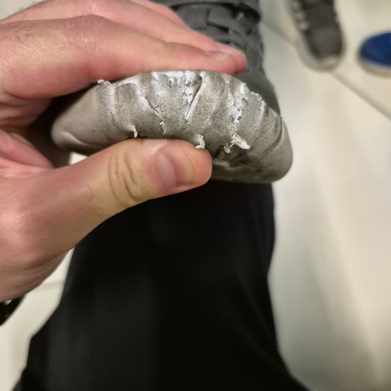 Yürüyen Merdivende Güvenlik Zafiyeti Ve İlgisiz AVM Yönetimi