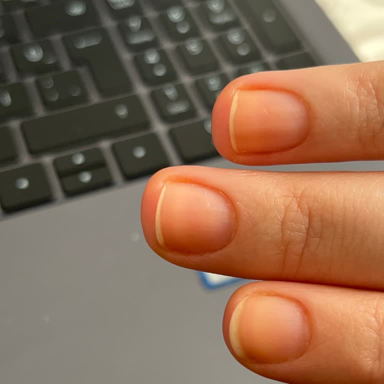 Flormar Oje Tırnaklarımda Kalıcı Sararmaya Neden Oldu, Açıklama Ve Çözüm Bekliyorum