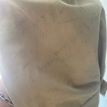 Vakko Çantadan Akan Boya Trençkotumu Mahvetti, Zararım Karşılanmadı