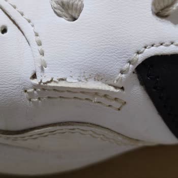 Adidas Ayakkabıda Kısa Sürede Yırtılma Ve Kullanıcı Hatası Gerekçesiyle Ret