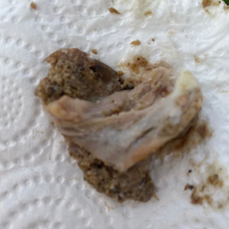 Kokoreç Diyarı 35 Kokoreç İçindeki Dışkı Kalıntıları