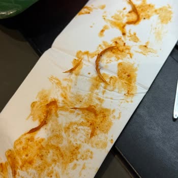 Satın Aldığım Piliç Kanat Ürününde Belirgin Kıllar Ve Hijyen Sorunu