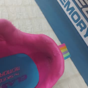 Çocuk Ayakkabısında Hızlı Yıpranma Ve Haksız Kullanıcı Hatası Değerlendirmesi