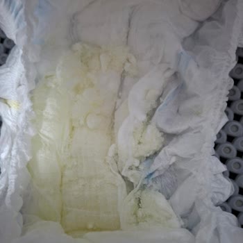 Bebek Bezi Sızıntısı Ve Müşteri Hizmetlerinde İlgisizlik