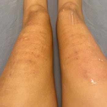 Ahu Karaduman Sağlıklı Yaşam Merkezi Mesuliyet Kabul Etmedi