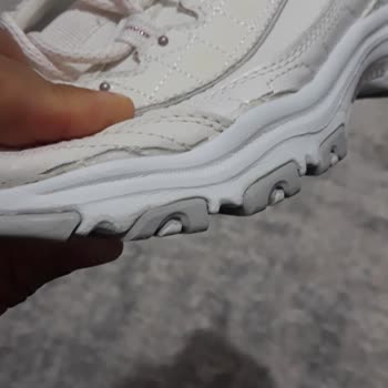Skechers Kısa Sürede Deforme Olan Ayakkabıya Firma Desteği Bekliyorum