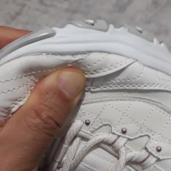 Skechers Kısa Sürede Deforme Olan Ayakkabıya Firma Desteği Bekliyorum