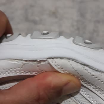Skechers Kısa Sürede Deforme Olan Ayakkabıya Firma Desteği Bekliyorum