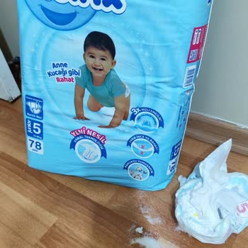 Molfix Bebek Bezi Ciddi Sağlık Sorunlarına Ve Sızdırma Problemine Yol Açtı