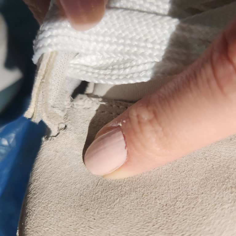 Kısa Sürede Deforme Olan Adidas Ayakkabım İçin Değişim Talebim