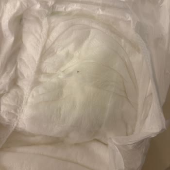 Bebek Bezi Paketinden Çıkan Yabancı Maddeler Nedeniyle Endişe