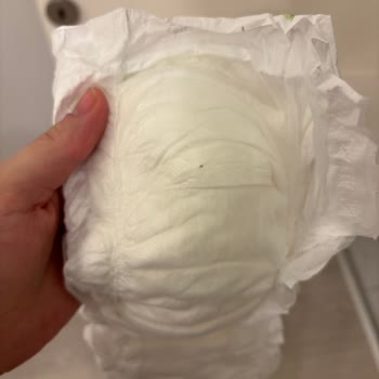 Bebek Bezi Paketinden Çıkan Yabancı Maddeler Nedeniyle Endişe