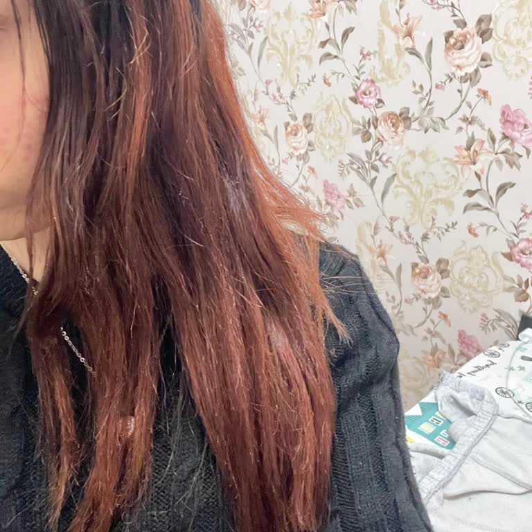 Kuaförde Saçım Yandı Ve Beklemediğim Sonuçla Karşılaştım