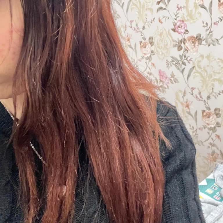 Saç Açma İşleminde Yanlış Yönlendirme Ve Sonuçsuz Hizmet