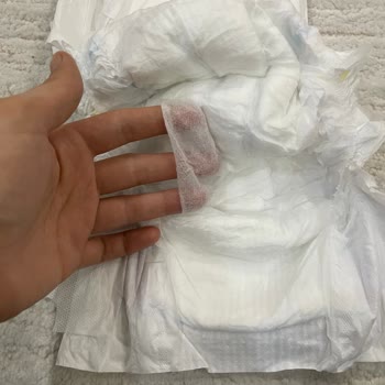 Molfix 5 Numara Bebek Bezinde Üretim Hatası Ve Cilt Sorunları