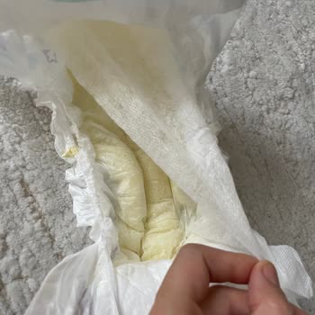 Molfix 5 Numara Bebek Bezinde Üretim Hatası Ve Cilt Sorunları