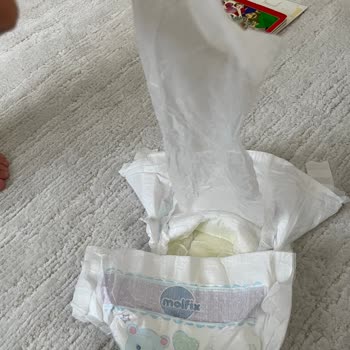 Molfix Junior Size 5 Diaper Defect Caused Red Spots and Itching